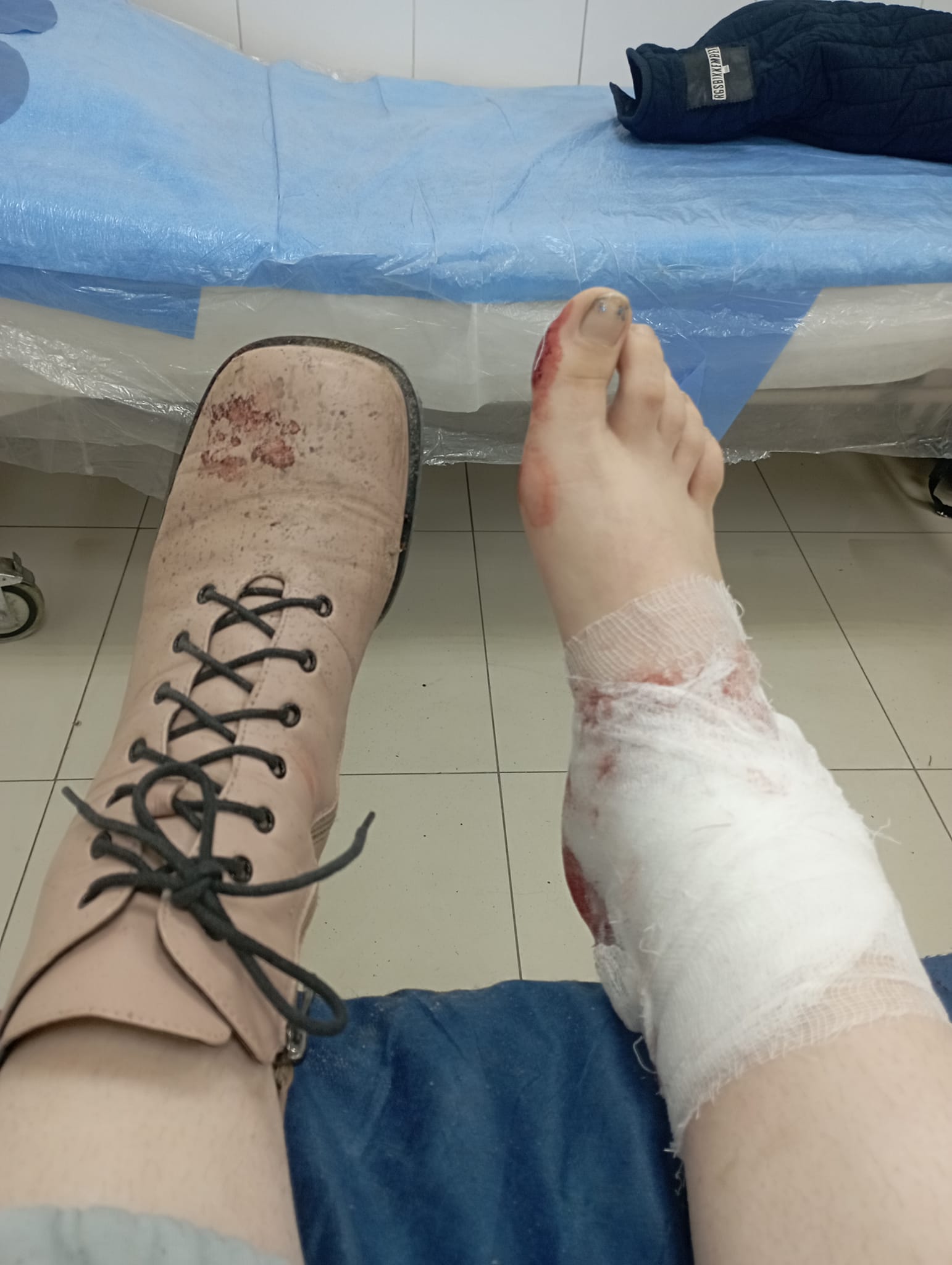 Журналістка Анна М’ясникова отримала перелом гомілки під час російського обстрілу Харкова