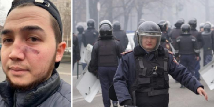 Журналіст Бек Байтасов (ліворуч), який отримав поранення обличчя 5 січня. Фото –Orda.kz-AFP