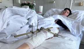 Ukrinform journalist Olha Zvonaryova, wounded in Zaporizhzhia. Photo by Ukrinform